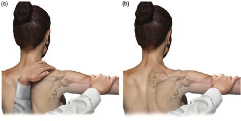 metal brackets pulled from left scapula|shoulder scapular retraction test.